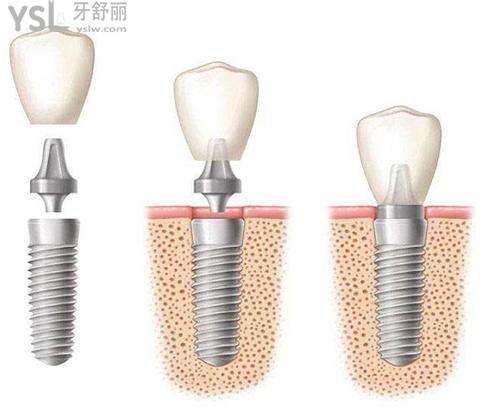 下載.jpg