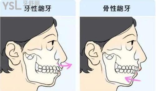 u=671220965,484620349&fm=11&gp=0.jpg