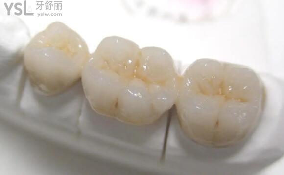 澤康全瓷牙怎么樣