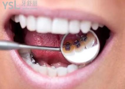 Dingtalk_20201202185412.jpg