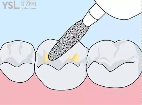 磨牙