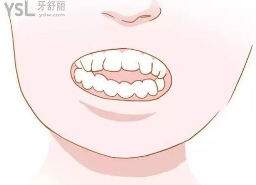 u=308235665,740317211&fm=26&gp=0.jpg