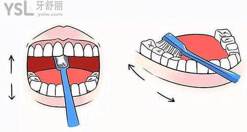 30多歲滿口牙都壞了怎么辦？