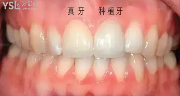 牙齒圖