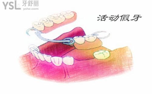 u=3303678970,1905152737&fm=26&gp=0.jpg