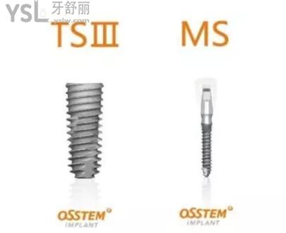 韓國奧齒泰（OSSTEM）種植體