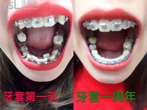 u=3236702326,3524936763&fm=26&gp=0.jpg