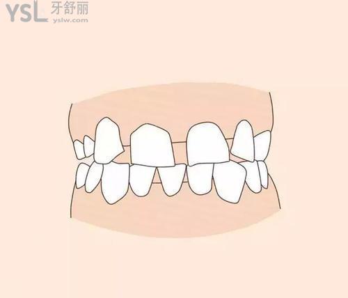 u=4092708904,1464787836&fm=26&gp=0.jpg