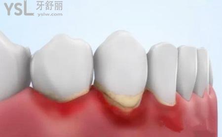 u=1961287940,3614029443&fm=26&gp=0.jpg