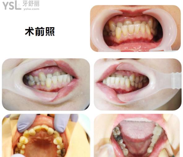 矯正4 (1).jpg