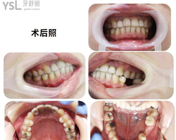 矯正4 (2).jpg