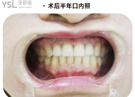 矯正4 (3).jpg