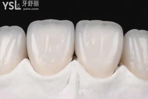 1000元的全瓷牙和1500的區(qū)別，2500元的全瓷牙的區(qū)別都是什么