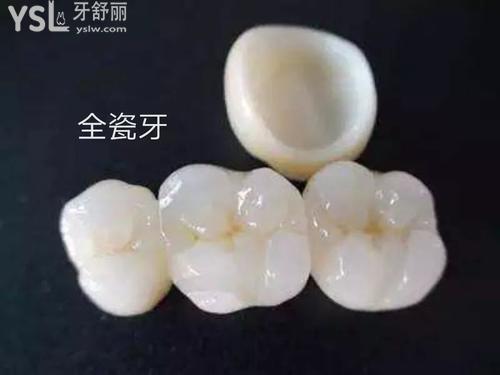 1000元的全瓷牙和1500的區(qū)別，2500元的全瓷牙的區(qū)別都是什么