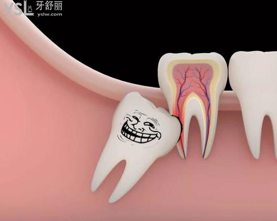 拔智齒后悔死了是真的嗎，拔智齒會很疼嗎？