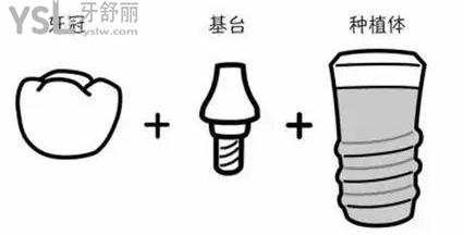 小知齒課堂2021007期：開扒3000元的種植牙靠譜嗎 (3).jpg