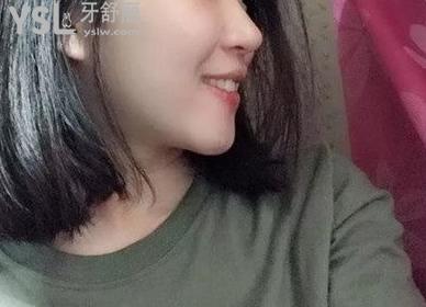曉萌牙講座018章：帶來帶牙套1~12月變化圖 (6).jpg