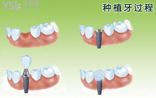 下載.jpg