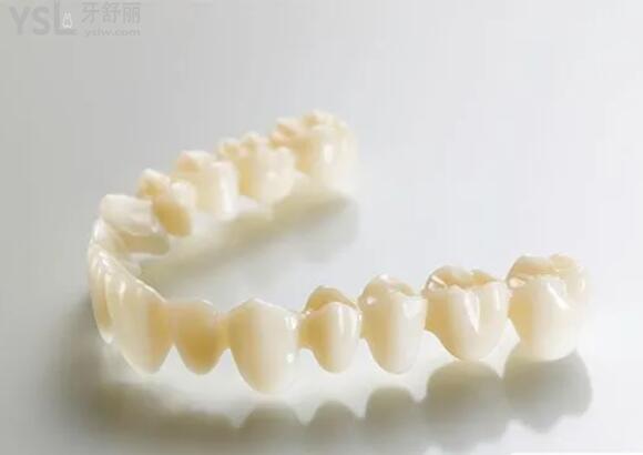 全瓷牙哪個品牌質(zhì)量好