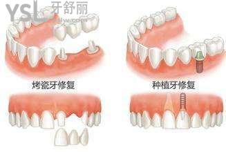 u=1446384202,4208309161&fm=26&gp=0.jpg