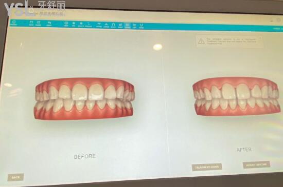 福州登特口腔醫(yī)院矯正牙齒怎么樣