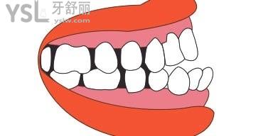 u=92487436,1777432547&fm=26&gp=0.jpg