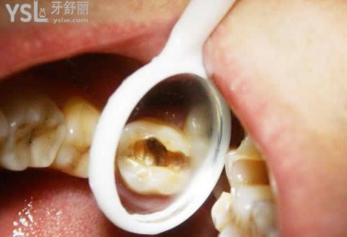 圖片參考2