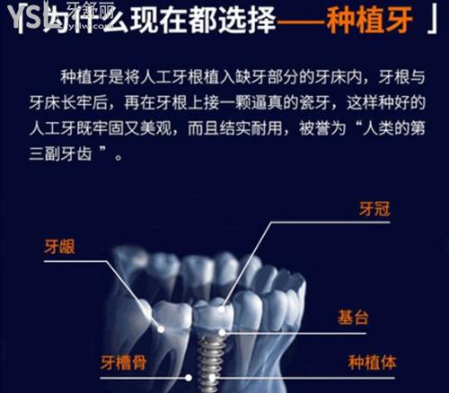 大慶晨光口腔種植牙