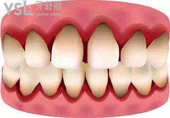 u=3517986497,4068485763&fm=26&gp=0.jpg