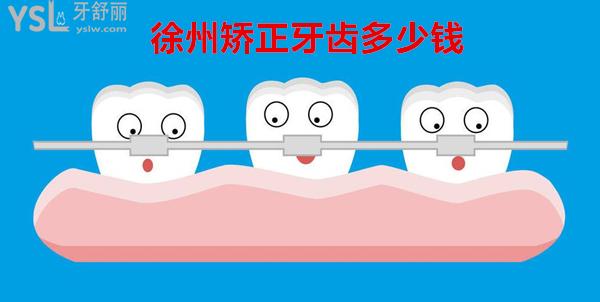 徐州矯正牙齒多少錢
