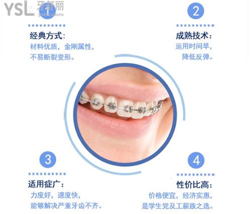 深圳爾睦口腔金屬矯正優(yōu)勢