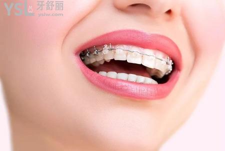 牙齒矯正后遺癥和危害有哪些？