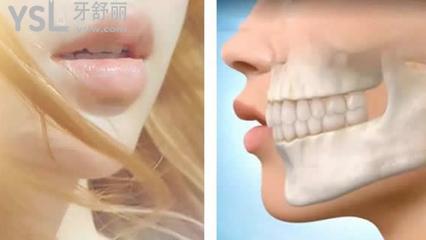 牙齒矯正