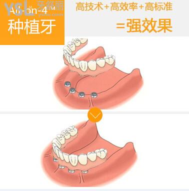 u=209585851,2573948967&fm=26&gp=0.jpg