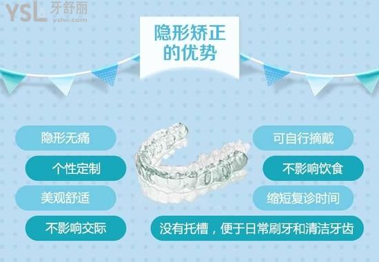時(shí)代天使隱形矯正1