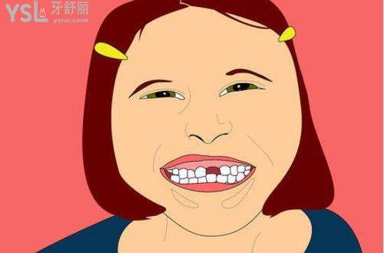 卡通缺牙配圖