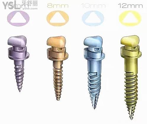 支抗釘?shù)姆N類