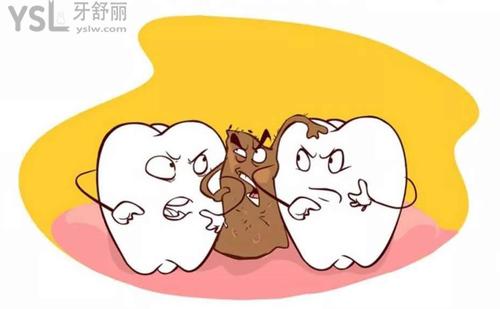 牙周炎怎么治療1