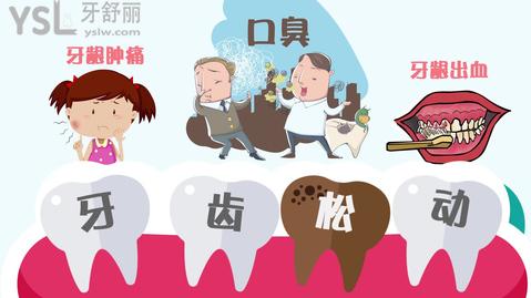 牙周炎有什么癥狀?