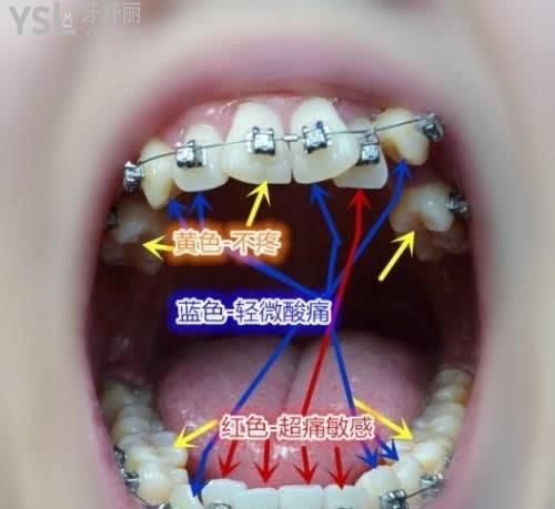 src=http%3A%2F%2Fimgsa.baidu.com%2Fexp%2Fw%3D500%2Fsign%3Df0d9da34b47eca80120539e7a1229712%2Fa6efce1b9d16fdfaed99baf9b08f8c5494ee7b2b.jpg&refer=http%3A%2F%2Fimgsa.baidu.jpg