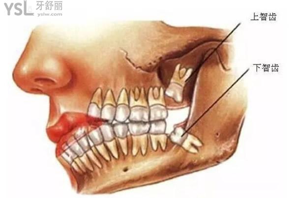 智齒圖