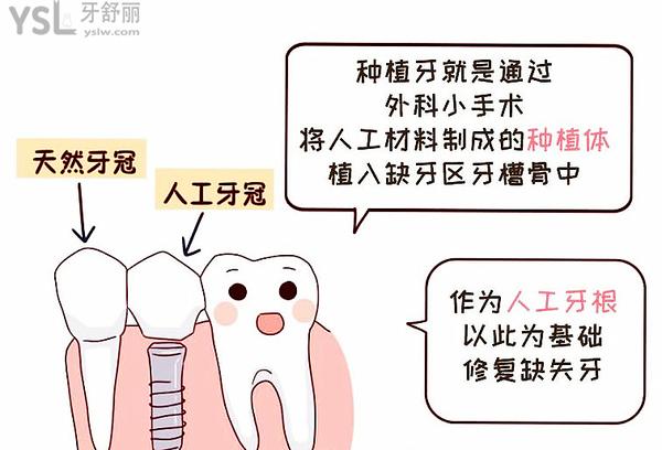 種植牙既然這么火，那種植牙人老了有沒有弊端？