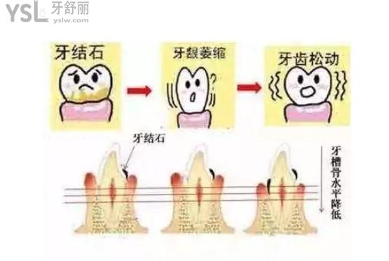 牙槽骨配圖
