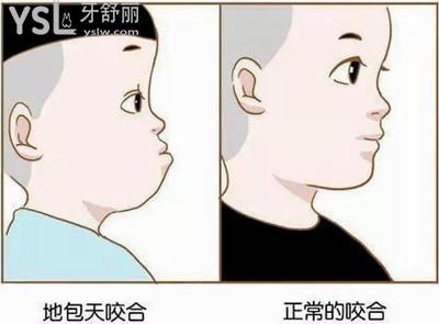 還指望小孩子地包天能自愈嗎？等下去你可能后悔