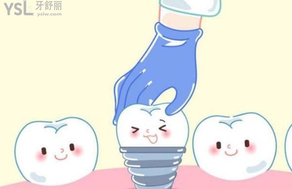 種植牙卡通圖