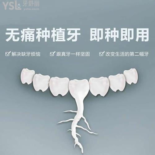 當(dāng)天種牙當(dāng)天用是真的嗎？即刻種植也分情況！