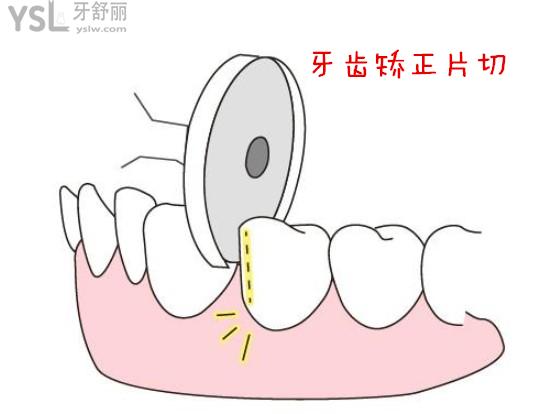 片切