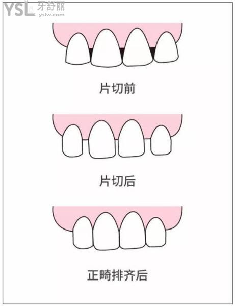片切前后對(duì)比