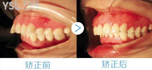 牙性問題