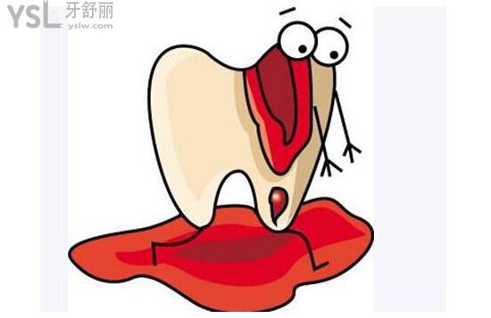 牙齦出血網(wǎng)絡(luò)配圖
